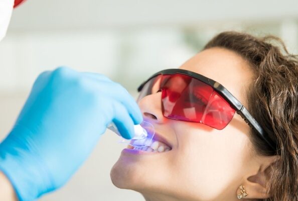 philips zoom 4 teeth whitening