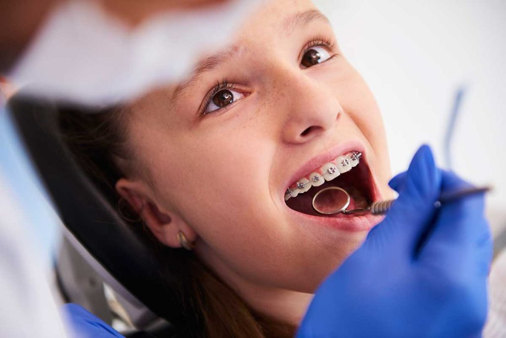 dental braces for kids